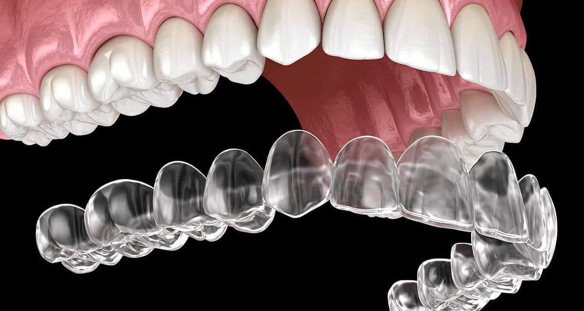 Orthodontic Treatment
